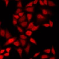 CSRP2BP Antibody