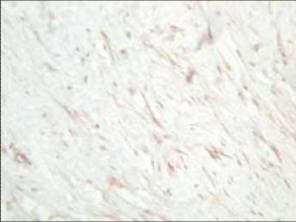 IHC-plus™ SFRP1 Antibody