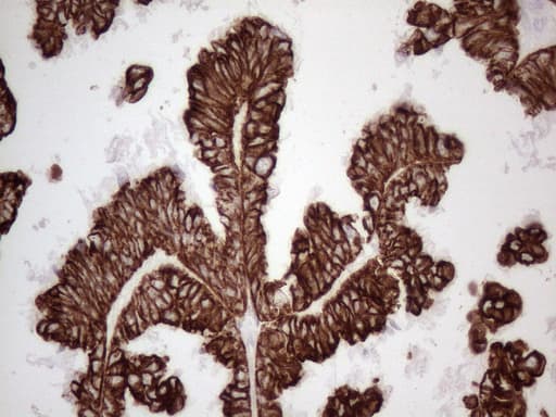 KRT16 / CK16 / Cytokeratin 16 Antibody (clone OTI2H8)
