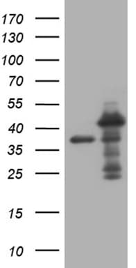 MED27 / CRSP8 Antibody (aa24-247, clone OTI2A4, Carrier-free)