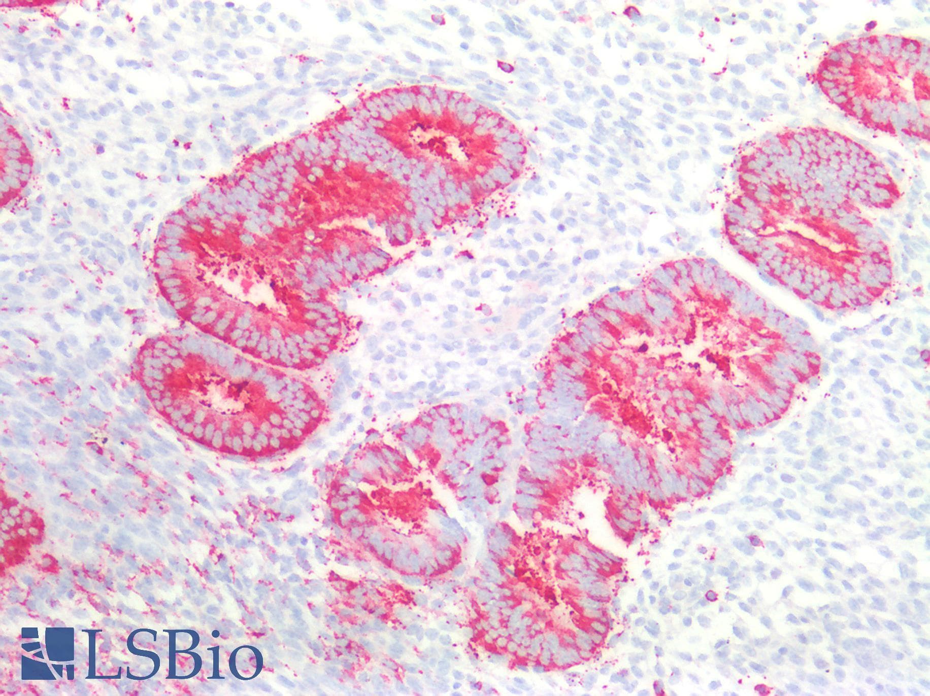 Polyclonal Rabbit anti-Human REXO2 Antibody (aa41-213, IHC, WB)