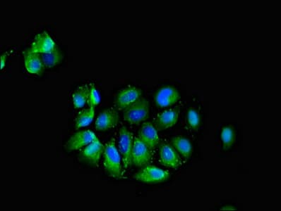 NECL-1 / CADM3 Antibody