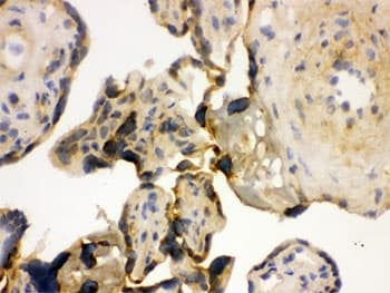 Polyclonal Rabbit anti-Human YBX1 / YB1 Antibody (IHC, WB)