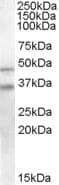 IHC-plus™ CED6 / GULP1 Antibody (aa291-304)