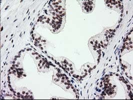 PRKCE / PKC-Epsilon Antibody (clone OTI4G8)