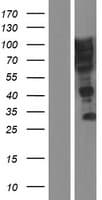 SUSD5 Protein (Over-Expression Lysate Myc-DDK (Flag))
