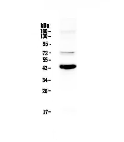 Polyclonal Rabbit anti-Human PAX5 Antibody (IHC, WB)