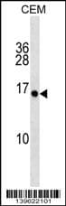 PLGLA Antibody (aa 23-48, N-term)