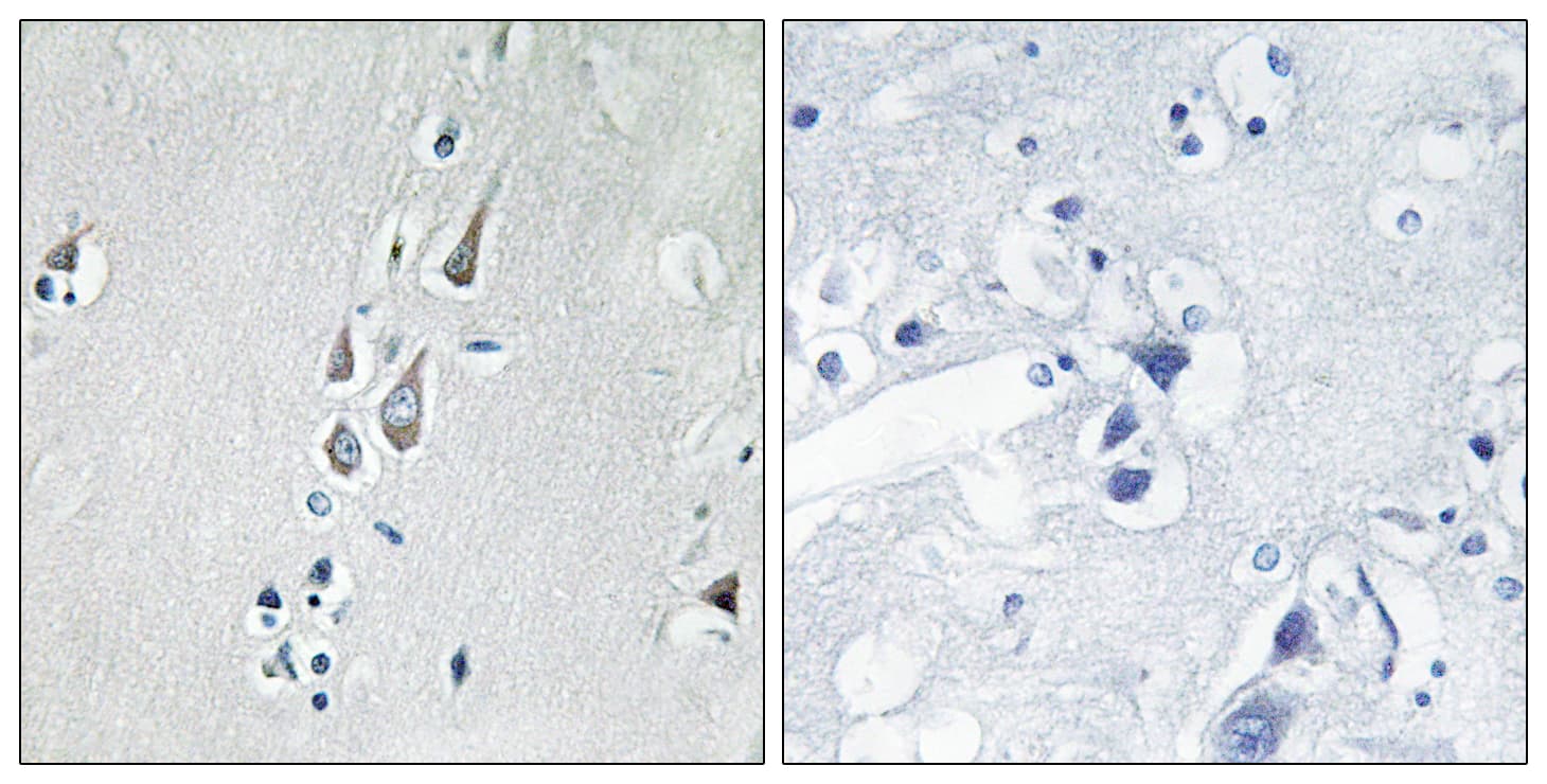 CAMK2 / CAMKII Antibody (phospho-Thr286)
