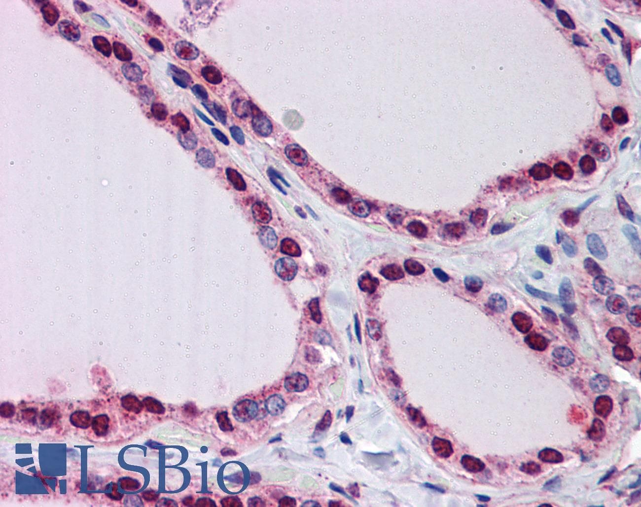 LPIN1 / Lipin 1 Antibody (aa218-267)
