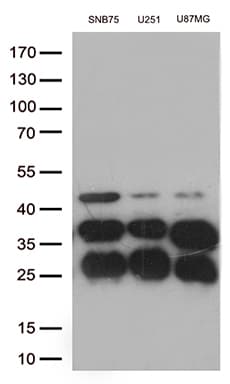 CTSL / Cathepsin L Antibody (aa114-333, clone OTI2C10)