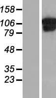 Human COL6A1 / Collagen VI Alpha 1 Protein (Over-Expression Lysate Myc-DDK (Flag))