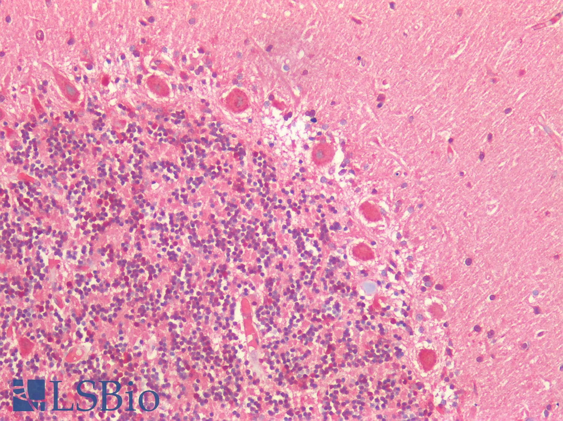 IHC-plus™ Polyclonal Rabbit anti-Human ATG16L1 / ATG16L Antibody (IHC)