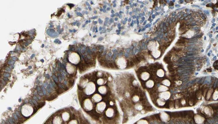 Polyclonal Rabbit anti-Human ATP1A1 Antibody (phospho-Ser16, IHC, IF, WB)