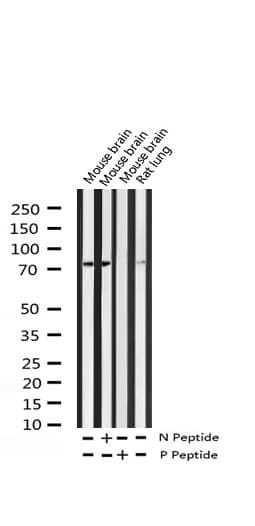 LIMK2 Antibody (phospho-Ser283)
