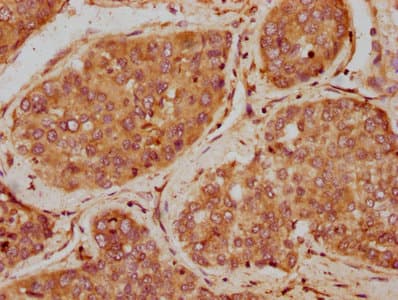 IGF1R / IGF1 Receptor Antibody