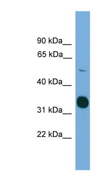 Polyclonal Rabbit anti-Human STK11 / LKB1 Antibody (aa317-366, WB)
