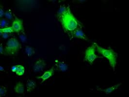 TS / Thromboxane Synthase Antibody (clone OTI1B8)