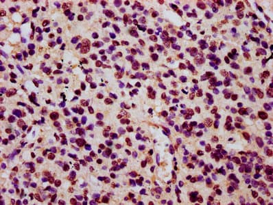Polyclonal Rabbit anti-Human HIST1H3A Antibody (IHC, IF, WB)
