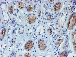 DOK7 Antibody (clone OTI5C6)