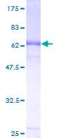 Human FTSJ1 Protein (Recombinant GST)