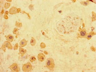 ARHGDIG / RHOGDI-3 Antibody