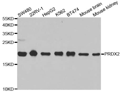 IHC-plus™ PRDX2 / Peroxiredoxin 2 Antibody