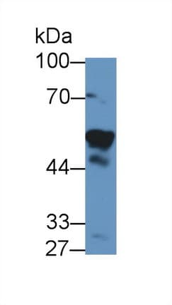 NAMPT / Visfatin Antibody (aa1-491, APC)