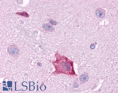 PathPlus™ Polyclonal Rabbit anti-Human RORA / ROR Alpha Antibody (Ligand-binding Domain, IHC)