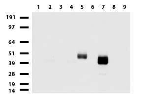 PROCR / EPCR Antibody (aa1-210, clone UMAB200)