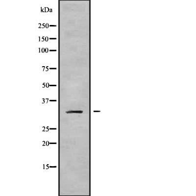 MRPL19 Antibody