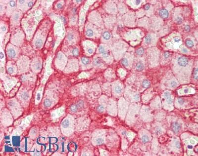 IHC-plus™ Polyclonal Rabbit anti-Human SLC2A2 / GLUT2 Antibody (Internal, IHC, WB)