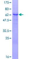 Human SGK2 Protein (Recombinant GST)