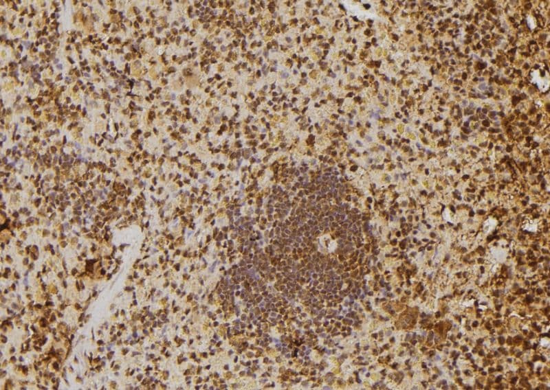 SKIV2L2 Antibody