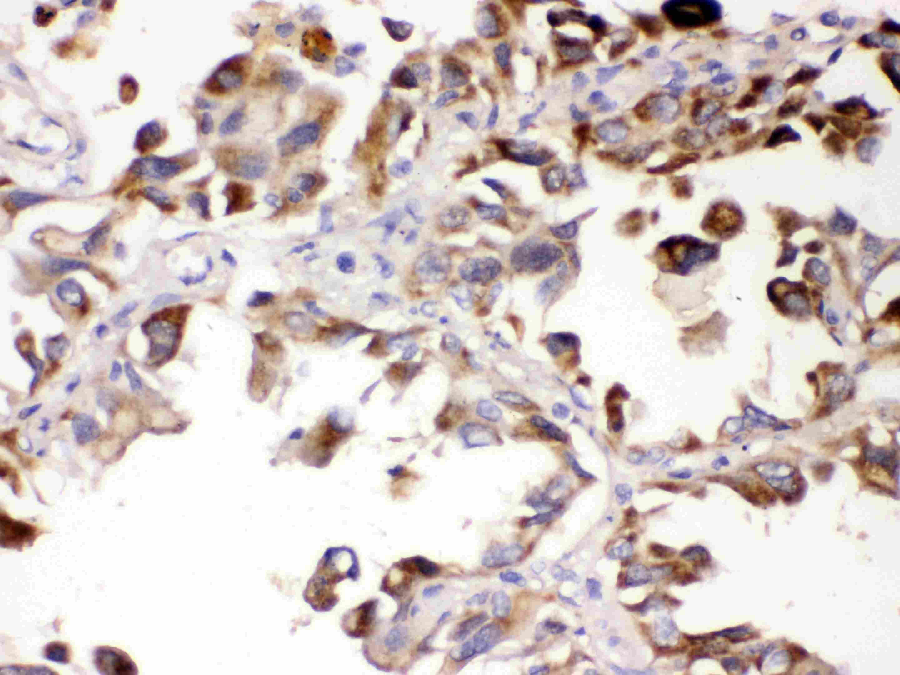 Polyclonal Rabbit anti-Human ALDH7A1 Antibody (IHC, WB)