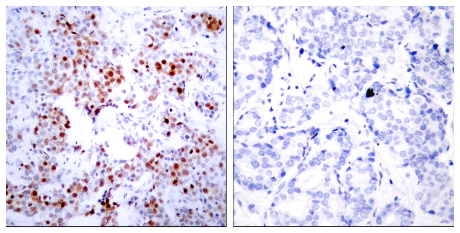 ATF2 Antibody (aa35-84)