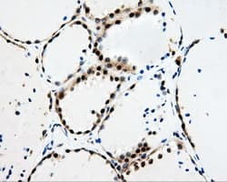 HDHD2 Antibody (clone OTI2C12)