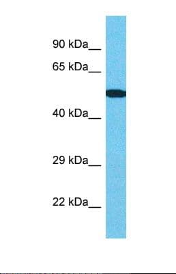 CENPI / CENP-I Antibody (aa39-88)