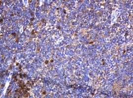 Monoclonal Mouse anti-Human c-Kit / CD117 Antibody (clone OTI3F9, aa546-976, IHC, WB)