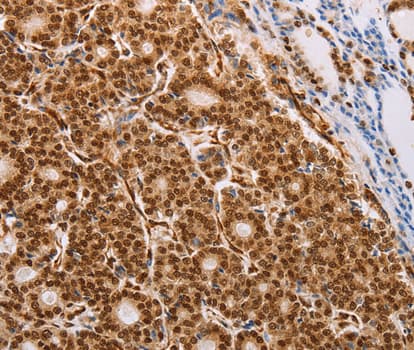 p58 / PSMD3 Antibody