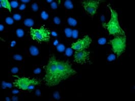 KATNB1 Antibody (clone OTI5C4, Carrier-free)