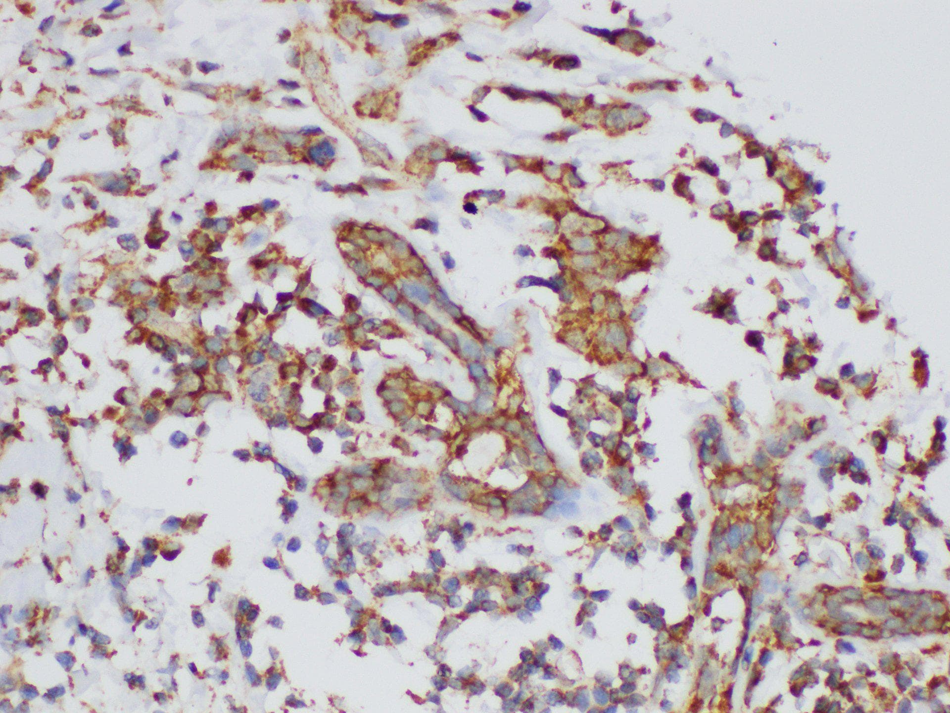 KLK6 / Kallikrein 6 Antibody
