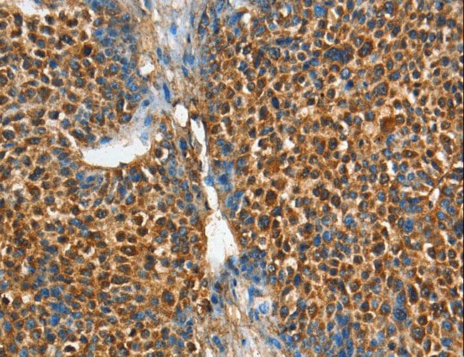 Polyclonal Rabbit anti-Human ADCY4 / Adenylate Cyclase 4 Antibody (IHC)