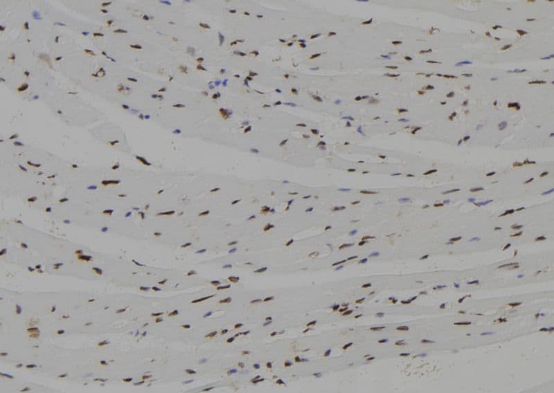 NHLH2 / HEN2 Antibody