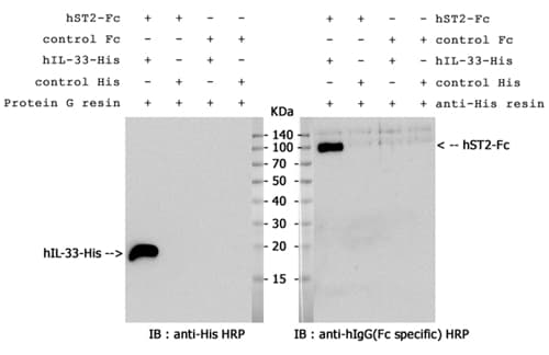 Human IL1RL1 Protein (Recombinant Human IgG1 Fc)