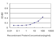 Monoclonal Mouse anti-Human SSX4 Antibody (clone 3E10, IF, WB)