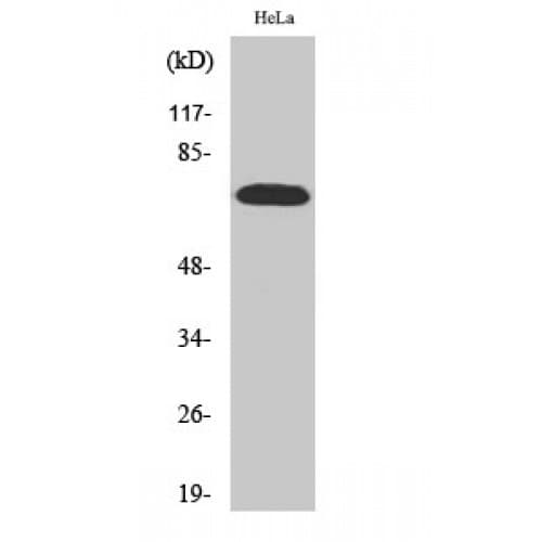 Polyclonal Rabbit anti-Human RPS6KB1 / P70S6K / S6K Antibody (310-390 aa, IHC, IF, WB)