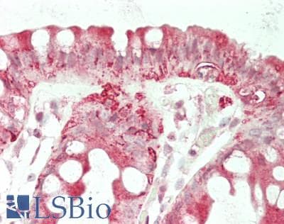 IHC-plus™ Monoclonal Mouse anti-Human DDX58 / RIG-1 / RIG-I Antibody (clone ABM4H29, aa1-220, IHC, WB)