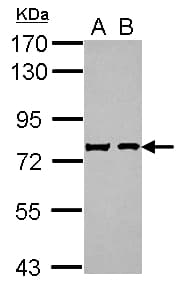 IHC-plus™ SCG2 / Secretogranin II Antibody