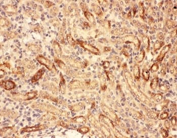 Polyclonal Rabbit anti-Mouse MMP7 / Matrilysin Antibody (aa95-264, IHC, WB)